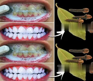 Blanchiment naturel : cette astuce blanchit les dents et élimine le tartre en 2 minutes