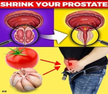 Recettes miracle pour réduisez naturellement la prostate !